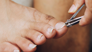 Ingrown Toenail Treatments Ingrown Toenail Treatments
