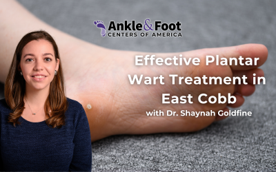 Effective Plantar Wart Treatment in East Cobb