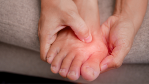 Bunion Symptoms