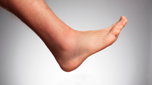 Peroneal Tendonitis Symptoms