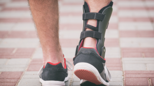 Peroneal Tendonitis Treatment