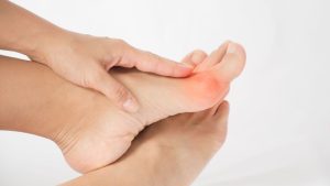 Relief from Big Toe Arthritis