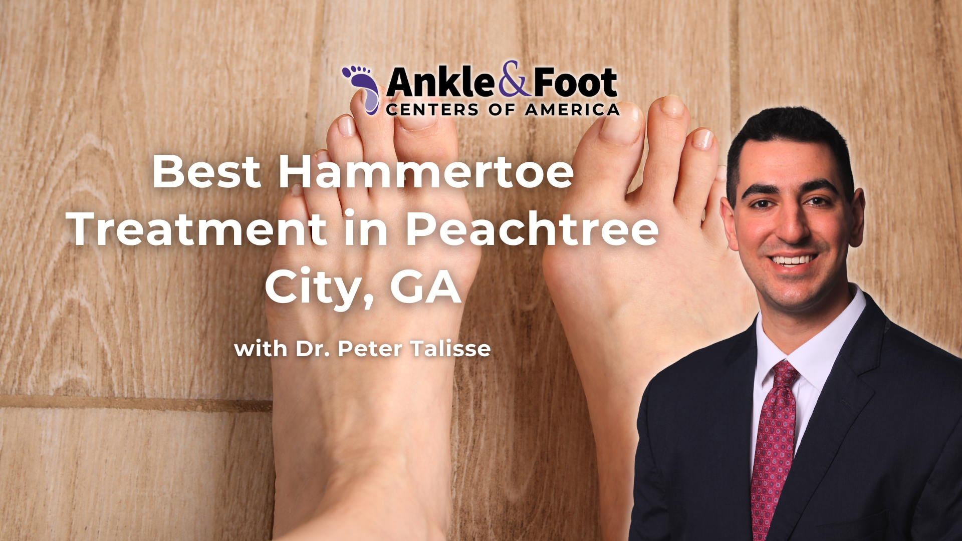 Hammertoe Treatment Peachtree City Ga Hammertoe Treatment Peachtree City Ga