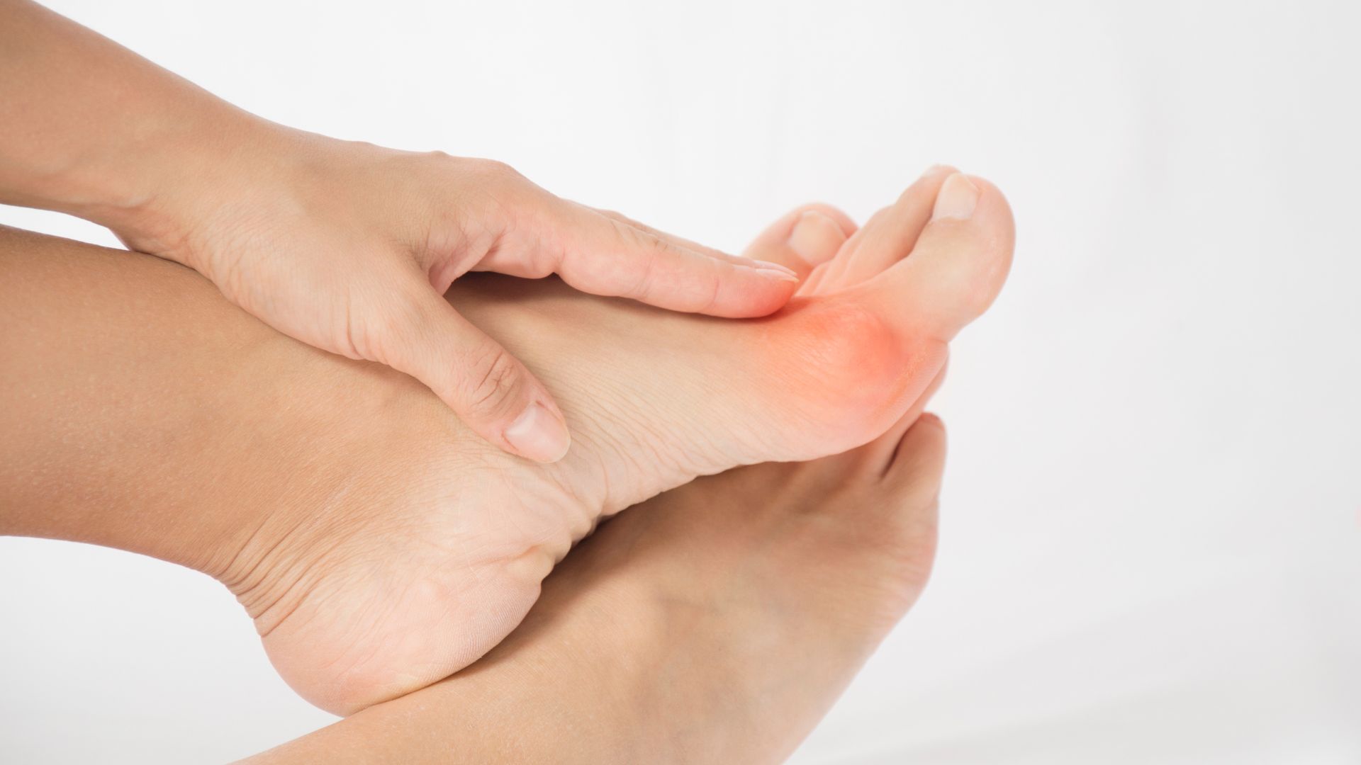 Bunion Symptoms