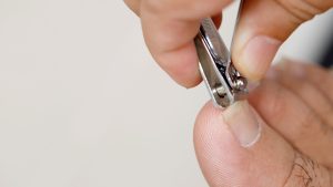 Causes of Ingrown Toenails