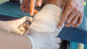 Leg Ulcer Treatment