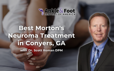 | Morton's Neuroma Treatment in Conyers, GAMorton’s Neuroma Treatment in Conyers, GA Best Morton’s Neuroma Treatment in Conyers, GA