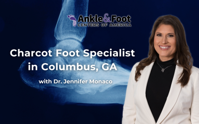 | Charcot Foot Columbus GACharcot Foot Columbus GA Charcot Foot Specialist in Columbus, Georgia