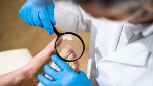 How to Treat an Ingrown Toenail