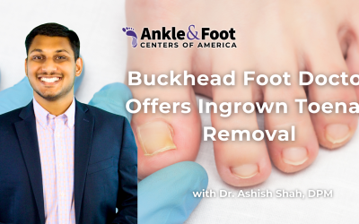 | Ingrown Toenail Removal Buckhead GAIngrown Toenail Removal Buckhead GA Buckhead Foot Doctor Offers Ingrown Toenail Removal