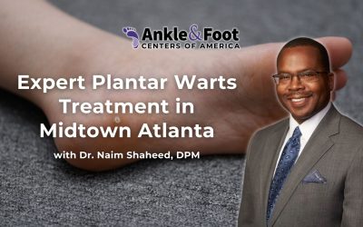 | Planta Warts Treatment Midtown AtlantaPlanta Warts Treatment Midtown Atlanta Expert Plantar Wart Treatment in Midtown Atlanta