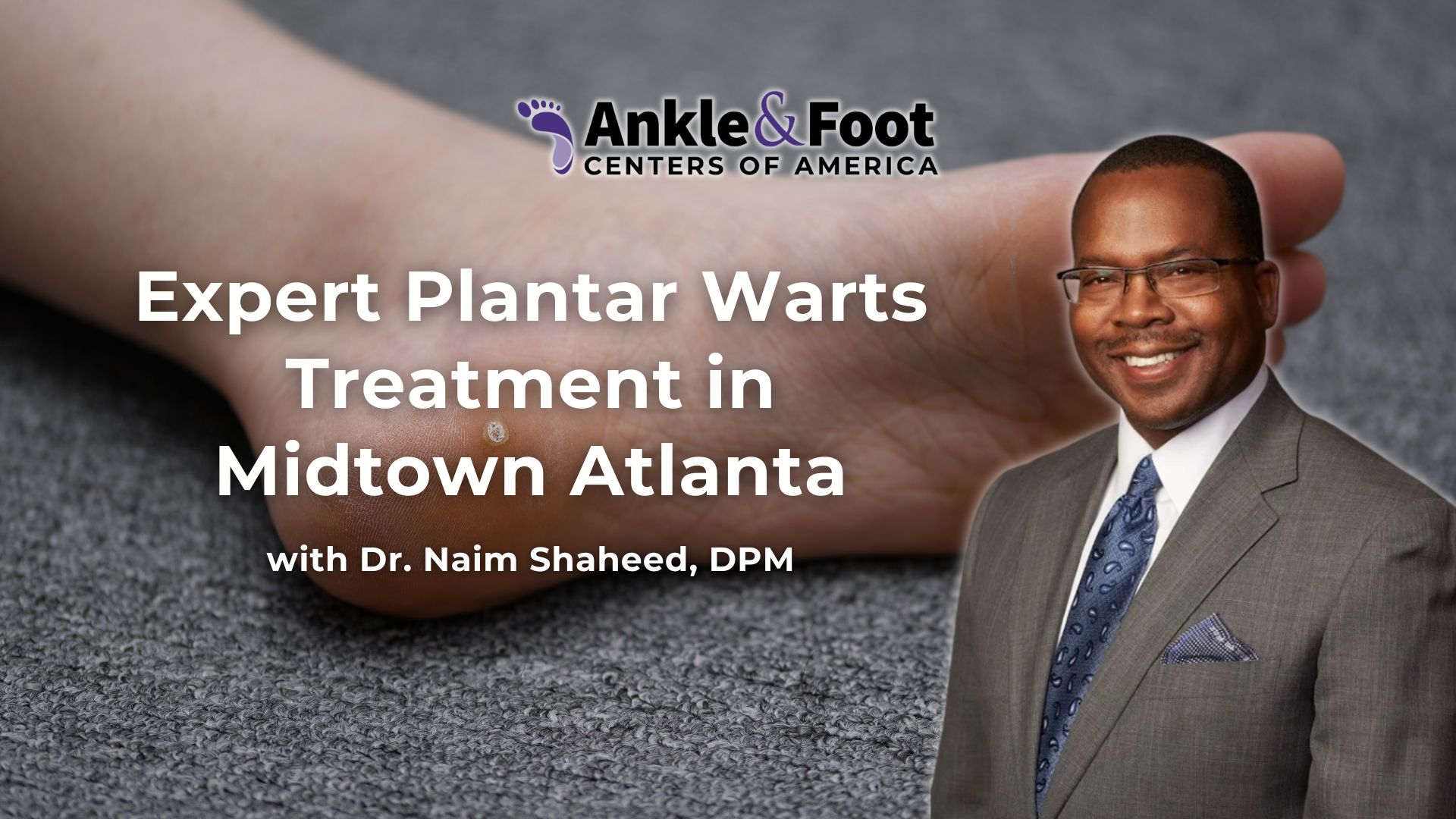 Planta Warts Treatment Midtown Atlanta Planta Warts Treatment Midtown Atlanta