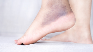 | When Should You See a Sports Injury Foot DoctorWhen Should You See a Sports Injury Foot Doctor When Should You See a Sports Injury Foot Doctor