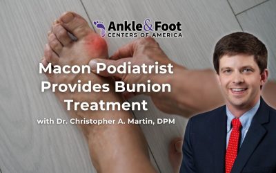 Macon Podiatrist Provides Bunion Treatment