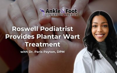 Roswell Podiatrist Provides Plantar Wart Treatment