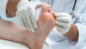 See a Podiatrist for a Wart on Your Foot