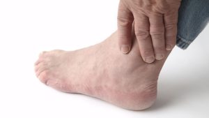 Could Ankle Pain Be Something Other Than Gout